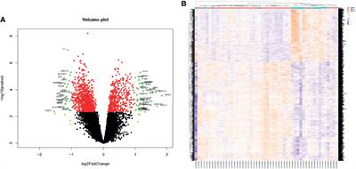 SLAMF8 Participates in Acute Renal Transplant Rejection via TLR4 Pathway on Pro-Inflammatory Macrophages